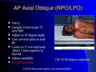 AP Axial Oblique (RPO/LPO) <ul><li>10x12 </li></ul><ul><li>Upright is best to get 72 inch SID </li></ul><ul><li>Adjust to ...