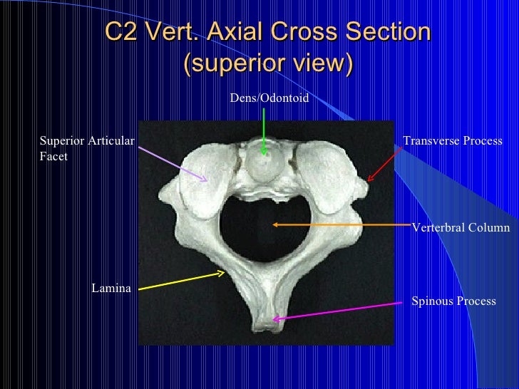 125 Week 11 Cervical Spine