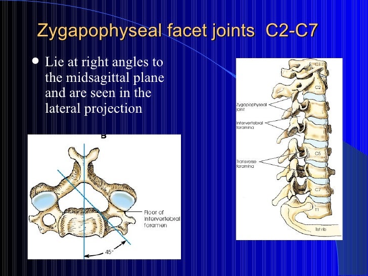 125 Week 11 Cervical Spine