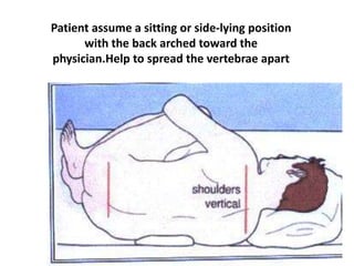 Patient assume a sitting or side-lying position
with the back arched toward the
physician.Help to spread the vertebrae apart
 