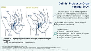 Gambar 5. Organ panggul normal dan tipe prolapsus organ
panggul
Dikutip dari Women Health Queensland.40
Definisi Prolapsus Organ
Panggul (POP)
Turunnya organ pelvis (kandung kemih,
uterus dan rektum) dari posisi anatomis
yang normal berupa penonjolan ke vagina
keluar maupun penekanan dinding vagina
Etiologi : disfungsi otot dasar panggul,
ligamentus dan fascia
Dibagi menjadi :
• Uterus ( uterine prolapse)
• Ujung vagina ( apical vaginal prolapse)
• Vagina anterior (cystocele)
• Vagina posterior ( rectocele)
4. ACOG ,2007, Pelvic Organ Prolapsuse ,Vol 110,No 3,717-29
5. Kuncharapu, I., Maheroni, B. A. & Johnson, D. W. (2010) Pelvic Organ Prolapsuse. American Academy of Family Physicians, 81(9), 1111-20.
6. Giarenis Iand Robinson D. Prevention and managementof pelvic organ prolapsuse. F1000Prime Reports 2014, 6:77.
7. Hagen S, Stark D. Conservative prevention and management of pelvic organ prolapsuse in women. Cochrane Database of Systematic Reviews 2011, Issue 12.
 