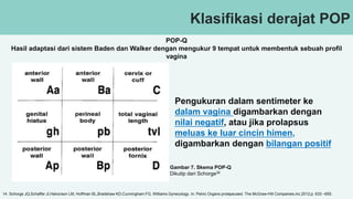 Klasifikasi derajat POP
POP-Q
Hasil adaptasi dari sistem Baden dan Walker dengan mengukur 9 tempat untuk membentuk sebuah profil
vagina
Gambar 7. Skema POP-Q
Dikutip dari Schorge39
Pengukuran dalam sentimeter ke
dalam vagina digambarkan dengan
nilai negatif, atau jika prolapsus
meluas ke luar cincin himen,
digambarkan dengan bilangan positif
14. Schorge JQ,Schaffer JI,Halvorson LM, Hoffman BL,Bradshaw KD,Cunningham FG. Williams Gynecology. In: Pelvic Organs prolapsused. The McGraw-Hill Companies,inc.2012;p. 633 –655.
 
