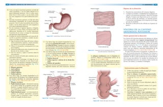 104 GRANT. MANUAL DE DISECCIÓN
10. Corte con tijeras el peritoneo parietal a un lado del
colon ascendente y con los dedos libérelo de la
pared abdominal posterior. Gire el colon ascen-
dente hacia la línea media y con los dedos suelte
los vasos sanguíneos de la pared abdominal poste-
rior.
11. Seccione el peritoneo parietal a un lado del colon
descendente separándolo de la pared abdominal
posterior. Gire el colon descendente hacia la línea
media y con los dedos separe los vasos sanguíneos
de la pared abdominal posterior.
12. En este momento el aparato digestivo, el hígado,
el páncreas y el bazo deben encontrarse libres de
adherencias. Retírelos de la cavidad abdominal.
Cerciórese de no torcer o romper las estructuras
del ligamento hepatoduodenal.
13. Coloque las vísceras abdominales en la mesa de di-
sección en posición anatómica y estudie sus por-
ciones en el plano anterior:
• Siga el trayecto de las ramas del tronco celíaco,
arteria mesentérica superior y arteria mesenté-
rica inferior en sus áreas de distribución.
• Observe la formación y terminación de la vena
porta hepática.
• Advierta las diferencias entre el patrón de rami-
ficación de las arterias y venas.
• Gire las vísceras y repita el ejercicio desde la
cara posterior.
14. Lleve las vísceras al lavabo para examinar sus ca-
racterísticas internas.
15. Con tijeras abra el estómago a lo largo de su su-
perficie anterior. Extienda el corte hasta la pri-
mera porción del duodeno. Enjuague la mucosa y
observe las características siguientes (fig. 4-39):
[G 129; L 231; N 276; R 294; C 209]
• Pliegues gástricos
• Antro pilórico
• Canal pilórico
• Esfínter pilórico
• Orificio pilórico
16. Con tijeras haga una incisión longitudinal en la
pared anterior del duodeno. En la segunda porción
del duodeno identifique las estructuras siguientes
(fig. 4-40): [G 133; L 238; N 279; R 297; C 224]
• Pliegues circulares
• Papila duodenal mayor – elevación de mucosa
en la pared medial de la segunda porción del
duodeno. La papila duodenal mayor es el orifi-
cio compartido del conducto pancreático prin-
cipal y el conducto biliar.
• Papila duodenal menor – es el sitio donde de-
semboca el conducto pancreático accesorio.
Cuando existe, se encuentra a unos 2 cm por
arriba de la papila duodenal mayor.
Esófago
Orificio cardias
del estómago
Esfínter pilórico
Orificio pilórico
Duodeno
Conducto pilórico
Antro pilórico
Pliegues gástricos
(rugosidades)
Figura 4-39. Características internas del estómago.
Pliegue longitudinal
Capucha Papila duodenal mayor
Papila duodenal menor
Pliegues
circulares
Figura 4-40. Características de la mucosa en la segunda porción (des-
cendente) del duodeno.
17. Con tijeras, haga una incisión longitudinal de 5 cm
en la porción proximal del yeyuno y otra en la por-
ción distal del íleon. Enjuague la mucosa y compare
las características. Advierta que los pliegues circulares
son más grandes y se encuentran más próximos entre
sí en el yeyuno (fig. 4-41). [G 136; N 280]
18. Con tijeras, haga una incisión de aproximadamente
7.5 cm en la pared anterior del ciego. Enjuague la
mucosa e identifique las estructuras siguientes
(fig. 4-42): [G 139; L 227; N 282; R 310; C 236]
• Orificio ileocecal
• Labios superior e inferior de la válvula ilio-
cecal
• Orificio del apéndice
19. Haga una incisión de aproximadamente 5 cm en la
superficie anterior del colon transverso. Advierta
1054/ ABDOMEN
Pliegues circulares
Porción proximal del yeyuno
Posición distal del íleon
Figura 4-41. Comparación de las características de la mucosa en las
porciones proximal y distal del íleon.
los pliegues semilunares entre las haustras ad-
yacentes. Observe la uniformidad relativa de la
mucosa. [G 137; N 284; C 238]
20. Guarde las vísceras en una bolsa grande de plástico
o en la cavidad abdominal. Humedezca las mues-
tras frecuentemente con alguna solución que in-
hiba la formación de moho.
Repaso de la disección
1. Examine las características de la mucosa digestiva.
2. Compare la cantidad y complejidad de los pliegues cir-
culares en las porciones proximal y distal del intestino
delgado. Compare esta disposición con las característi-
cas de la mucosa del estómago y el intestino grueso.
Correlacione sus hallazgos con la función de los órga-
nos que ha estudiado.
3. Recuerde la ubicación de las válvulas en el aparato di-
gestivo.
VÍSCERAS DE LA CAVIDAD
ABDOMINAL POSTERIOR
Visión general de la disección
Las vísceras de la porción posterior del abdomen se ubican
en el área conocida como espacio retroperitoneal. Este
espacio no es real. Es una porción del cuerpo situada entre
el peritoneo parietal y los músculos y huesos de la pared
abdominal posterior (fig. 4-43). El espacio retroperitoneal
contiene los riñones, uréteres, glándulas suprarrenales,
aorta, vena cava inferior y porciones abdominales de los
troncos simpáticos. [G 171; L 243; N 342; R 324; C 260]
El orden de la disección es el siguiente: se palpan las vís-
ceras de la porción posterior del abdomen. Los riñones y
las glándulas suprarrenales se extraen de la fascia renal y se
examinan. Se lleva a cabo la disección de la aorta abdomi-
nal y la vena cava inferior. Se estudian los músculos de la
pared abdominal posterior. Se examina el plexo lumbar de
nervios. Por último, se estudiará el diafragma.
Válvula ileocecal:
Labio superior
Orificio
Labio inferior
Ciego
Apéndice
Orificio del
apéndice
Íleon
Figura 4-42. Interior del ciego, vista anterior.
Instrucciones para la disección
1. Utilice una esponja o toallas de papel para limpiar
la pared abdominal posterior.
2. Palpe los riñones y las glándulas suprarrenales.
Se encuentran a los lados de la columna vertebral
a nivel de T12 a L3. [G 163; L 242; N 329; R 331;
C 243]
3. Palpe la aorta abdominal.
4. Hacia la derecha de la aorta abdominal, palpe la
vena cava inferior.
5. Retire el peritoneo parietal restante de la pared
abdominal posterior.
6. Si su disección es la de un cadáver de sexo feme-
nino, vaya al paso número 10.
7. Identifique la arteria y vena testiculares en el
anillo inguinal profundo. Esta arteria es pequeña y
delicada. Siga el trayecto de los vasos testiculares
en sentido superior y advierta que cruzan por de-
lante del uréter. No lesione el uréter.
 