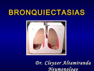 BRONQUIECTASIAS

Dr. Cleyzer Altamiranda
Neumonologo

 