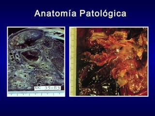 Anatomía Patológica

 