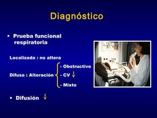 Diagnóstico
• Prueba funcional
respiratoria
Localizada : no altera
- Obstructivo
Difusa : Alteración

- CV
- Mixto

• Difusión

 