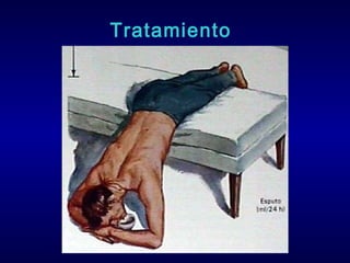 Tratamiento

 