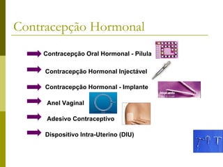 Contracepção Hormonal
Contracepção Oral Hormonal - Pílula
Contracepção Hormonal Injectável
Contracepção Hormonal - Implante
Anel Vaginal
Adesivo Contraceptivo
Dispositivo Intra-Uterino (DIU)

 