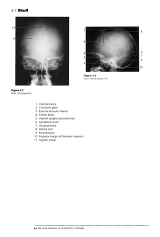 The Who Manual Of Diagnostic Imaging Radiographic Anatomy And ...