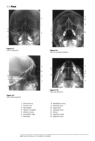 The Who Manual Of Diagnostic Imaging Radiographic Anatomy And ...