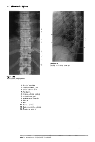 The Who Manual Of Diagnostic Imaging Radiographic Anatomy And ...