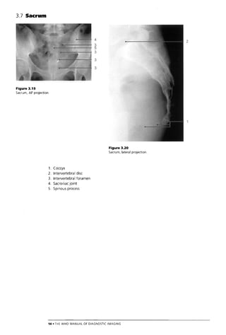The Who Manual Of Diagnostic Imaging Radiographic Anatomy And ...
