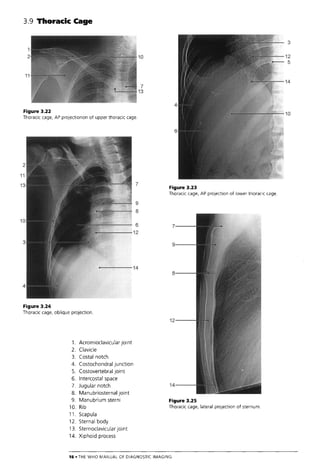 The Who Manual Of Diagnostic Imaging Radiographic Anatomy And ...