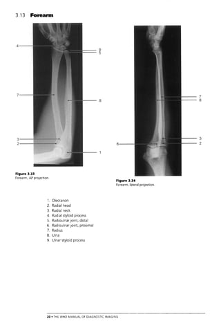 The Who Manual Of Diagnostic Imaging Radiographic Anatomy And ...
