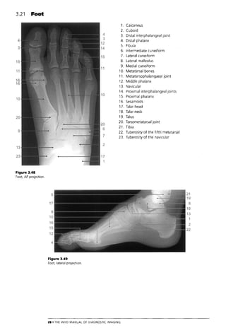 The Who Manual Of Diagnostic Imaging Radiographic Anatomy And ...