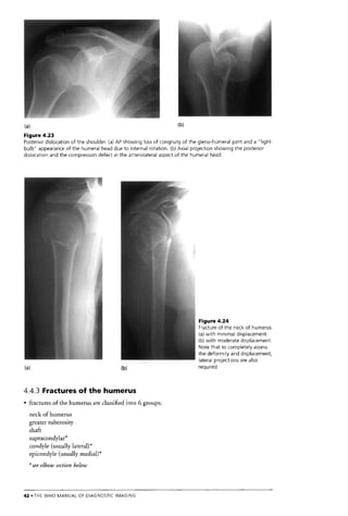The Who Manual Of Diagnostic Imaging Radiographic Anatomy And ...