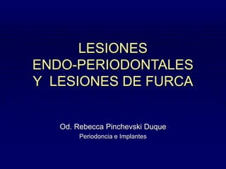 LESIONES
ENDO-PERIODONTALES
Y LESIONES DE FURCA
Od. Rebecca Pinchevski Duque
Periodoncia e Implantes
 