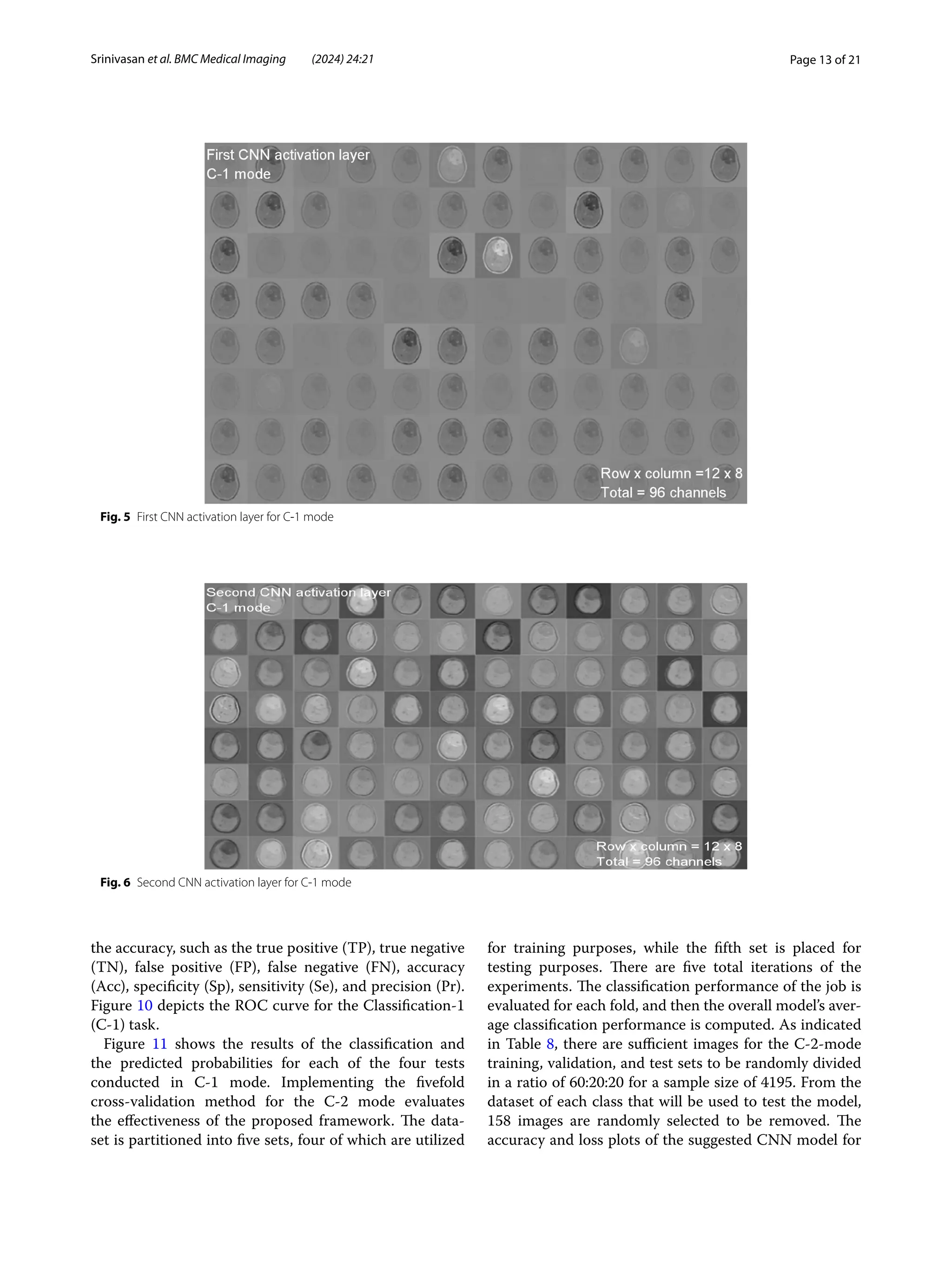 Page 13 of 21
Srinivasan et al. BMC Medical Imaging (2024) 24:21
the accuracy, such as the true positive (TP), true negative
(TN), false positive (FP), false negative (FN), accuracy
(Acc), specificity (Sp), sensitivity (Se), and precision (Pr).
Figure 10 depicts the ROC curve for the Classification-1
(C-1) task.
Figure 11 shows the results of the classification and
the predicted probabilities for each of the four tests
conducted in C-1 mode. Implementing the fivefold
cross-validation method for the C-2 mode evaluates
the effectiveness of the proposed framework. The data-
set is partitioned into five sets, four of which are utilized
for training purposes, while the fifth set is placed for
testing purposes. There are five total iterations of the
experiments. The classification performance of the job is
evaluated for each fold, and then the overall model’s aver-
age classification performance is computed. As indicated
in Table 8, there are sufficient images for the C-2-mode
training, validation, and test sets to be randomly divided
in a ratio of 60:20:20 for a sample size of 4195. From the
dataset of each class that will be used to test the model,
158 images are randomly selected to be removed. The
accuracy and loss plots of the suggested CNN model for
Fig. 5 First CNN activation layer for C-1 mode
Fig. 6 Second CNN activation layer for C-1 mode
 