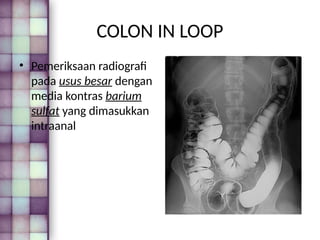 Loopografi Normal Radiologi 129550330-Macam-Pemeriksaan-Radiologi.pptx