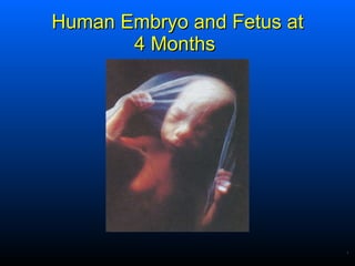 Human Embryo and Fetus at 4 Months  .   