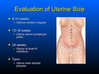 Evaluation of Uterine Size <ul><li>8-10 weeks </li></ul><ul><ul><li>Uterine contour irregular  </li></ul></ul><ul><li>12-1...