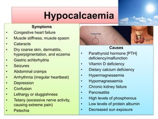Hypocalcaemia
Symptoms
• Congestive heart failure
• Muscle stiffness, muscle spasm
• Cataracts
• Dry coarse skin, dermatitis,
hyperpigmentation, and eczema
• Gastric achlorhydria
• Seizures
• Abdominal cramps
• Arrhythmia (irregular heartbeat)
• Depression
• Confusion
• Lethargy or sluggishness
• Tetany (excessive nerve activity,
causing extreme pain)
• Petechia
Causes
• Parathyroid hormone [PTH]
deficiency/malfunction
• Vitamin D deficiency
• Dietary calcium deficiency
• Hypermagnesaemia
• Hypomagnesaemia
• Chronic kidney failure
• Pancreatitis
• High levels of phosphorous
• Low levels of protein albumin
• Decreased sun exposure
 
