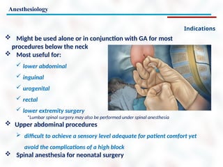 Anesthesiology
Indications
 Might be used alone or in conjunction with GA for most
procedures below the neck
 Most useful for:
 lower abdominal
 inguinal
 urogenital
 rectal
 lower extremity surgery
*Lumbar spinal surgery may also be performed under spinal anesthesia
 Upper abdominal procedures
 difficult to achieve a sensory level adequate for patient comfort yet
avoid the complications of a high block
 Spinal anesthesia for neonatal surgery
 