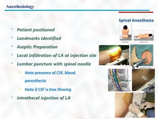 Anesthesiology
Spinal Anesthesia
 Patient positioned
 Landmarks identified
 Aseptic Preparation
 Local infiltration of LA at injection site
 Lumbar puncture with spinal needle
 Note presence of CSF, blood,
paresthesia
 Note if CSF is free flowing
 Intrathecal injection of LA
 