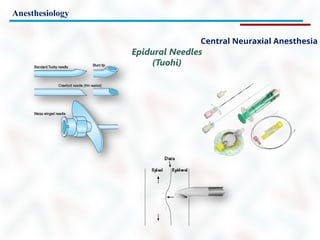 Anesthesiology
Epidural Needles
(Tuohi)
Central Neuraxial Anesthesia
 