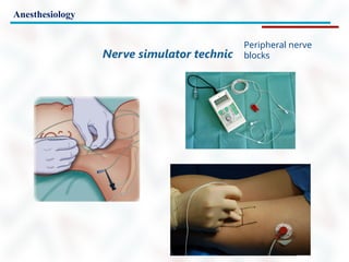 Anesthesiology
Peripheral nerve
blocks
Nerve simulator technic
 