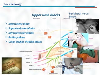 Anesthesiology
Peripheral nerve
blocks
Upper limb blocks
 Interscalene block
 Supraclavicular blocks
 Infraclavicular blocks
 Axillary block
 Ulnar, Radial, Median blocks
 