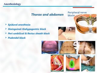 Anesthesiology
Peripheral nerve
blocks
Thorax and abdomen
 Epidural anesthesia
 Ilioinguinal-Iliohypogastric block
 Peri-umbilical & Rectus sheath block
 Pudendal block
 