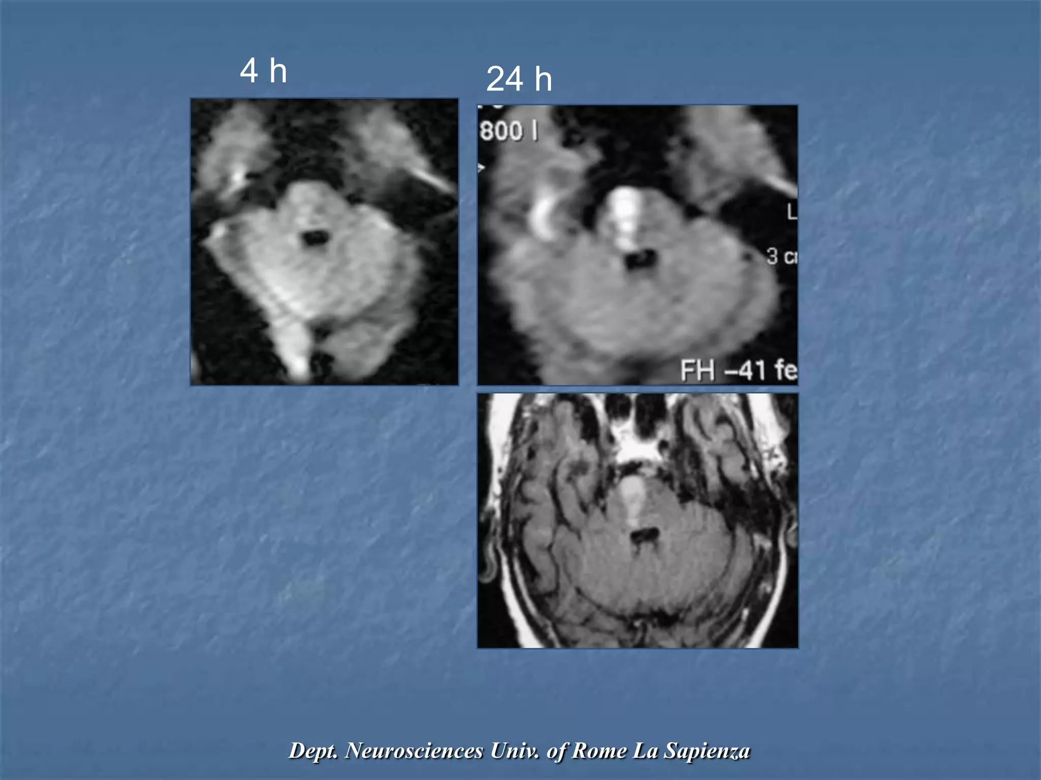 4 h 24 h
Dept. Neurosciences Univ. of Rome La Sapienza
 