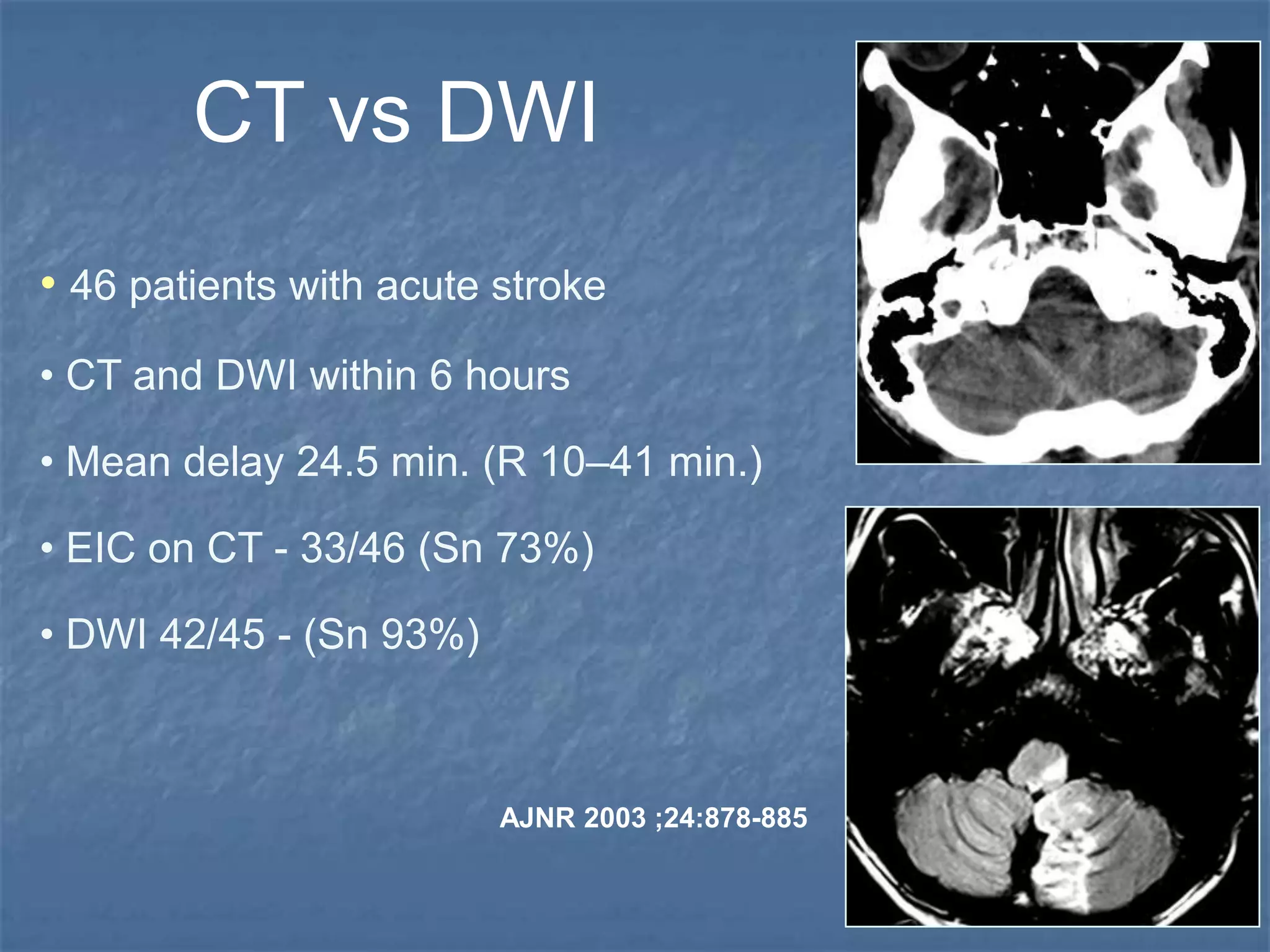 AJNR 2003 ;24:878-885
• 46 patients with acute stroke
• CT and DWI within 6 hours
• Mean delay 24.5 min. (R 10–41 min.)
• EIC on CT - 33/46 (Sn 73%)
• DWI 42/45 - (Sn 93%)
CT vs DWI
 