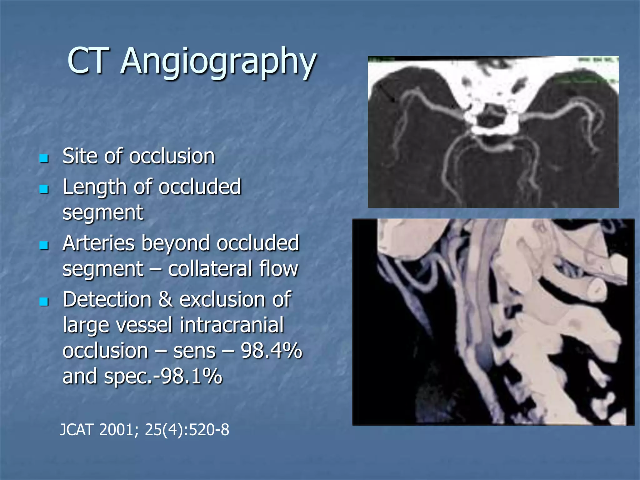 CT Angiography
 Site of occlusion
 Length of occluded
segment
 Arteries beyond occluded
segment – collateral flow
 Detection & exclusion of
large vessel intracranial
occlusion – sens – 98.4%
and spec.-98.1%
JCAT 2001; 25(4):520-8
 