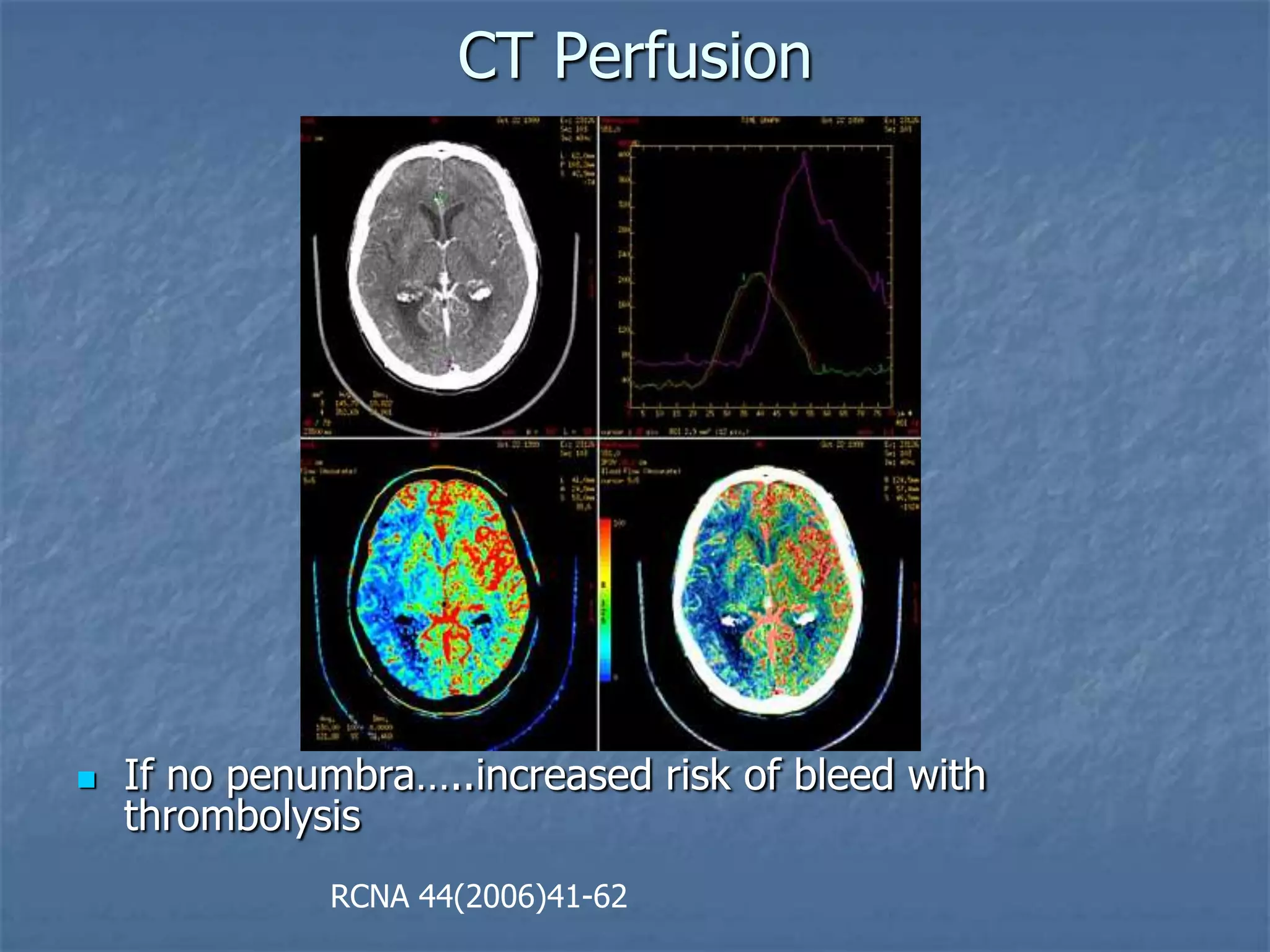 CT Perfusion
 If no penumbra…..increased risk of bleed with
thrombolysis
RCNA 44(2006)41-62
 