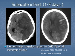 Sub Infarct 12 b. ct brain | PPT