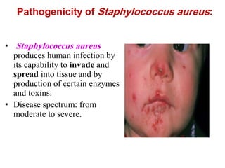 Pathogenicity of Staphylococcus aureus:
• Staphylococcus aureus
produces human infection by
its capability to invade and
spread into tissue and by
production of certain enzymes
and toxins.
• Disease spectrum: from
moderate to severe.
 