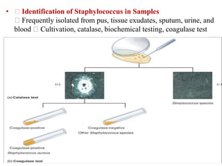 • Identification of Staphylococcus in Samples
Frequently isolated from pus, tissue exudates, sputum, urine, and
blood Cultivation, catalase, biochemical testing, coagulase test
 
