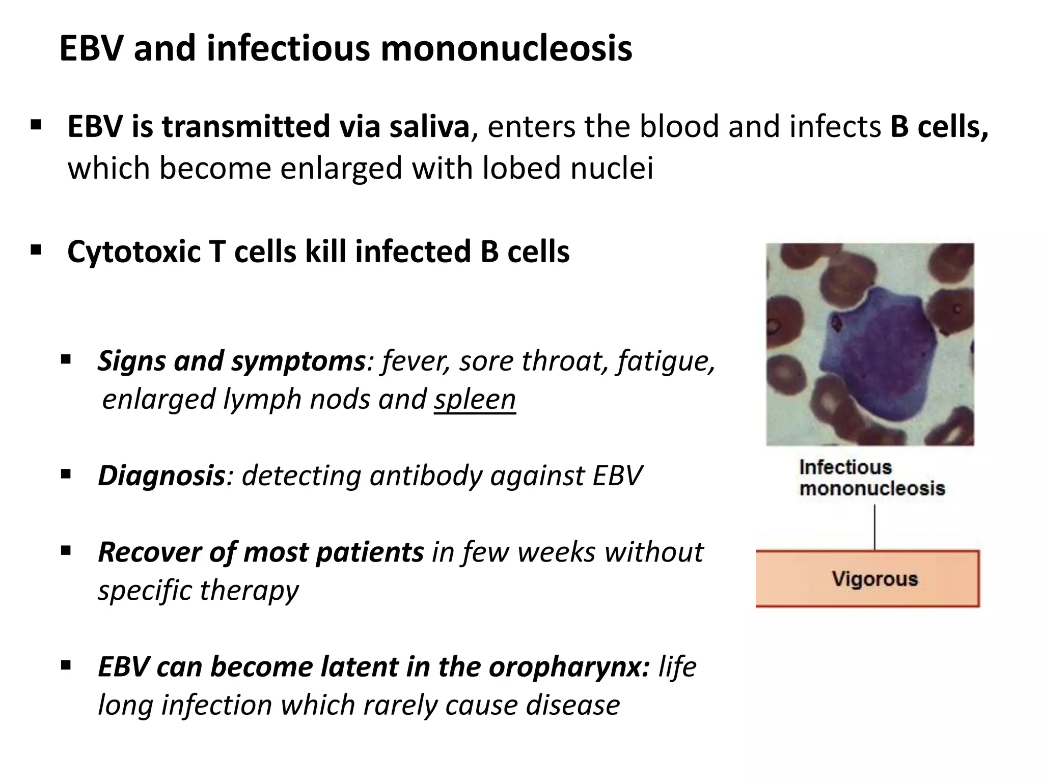 EBV and infectious mononucleosis
 EBV is transmitted via saliva, enters the blood and infects B cells,
which become enlarged with lobed nuclei
 Cytotoxic T cells kill infected B cells
 Signs and symptoms: fever, sore throat, fatigue,
enlarged lymph nods and spleen
 Diagnosis: detecting antibody against EBV
 Recover of most patients in few weeks without
specific therapy
 EBV can become latent in the oropharynx: life
long infection which rarely cause disease
 