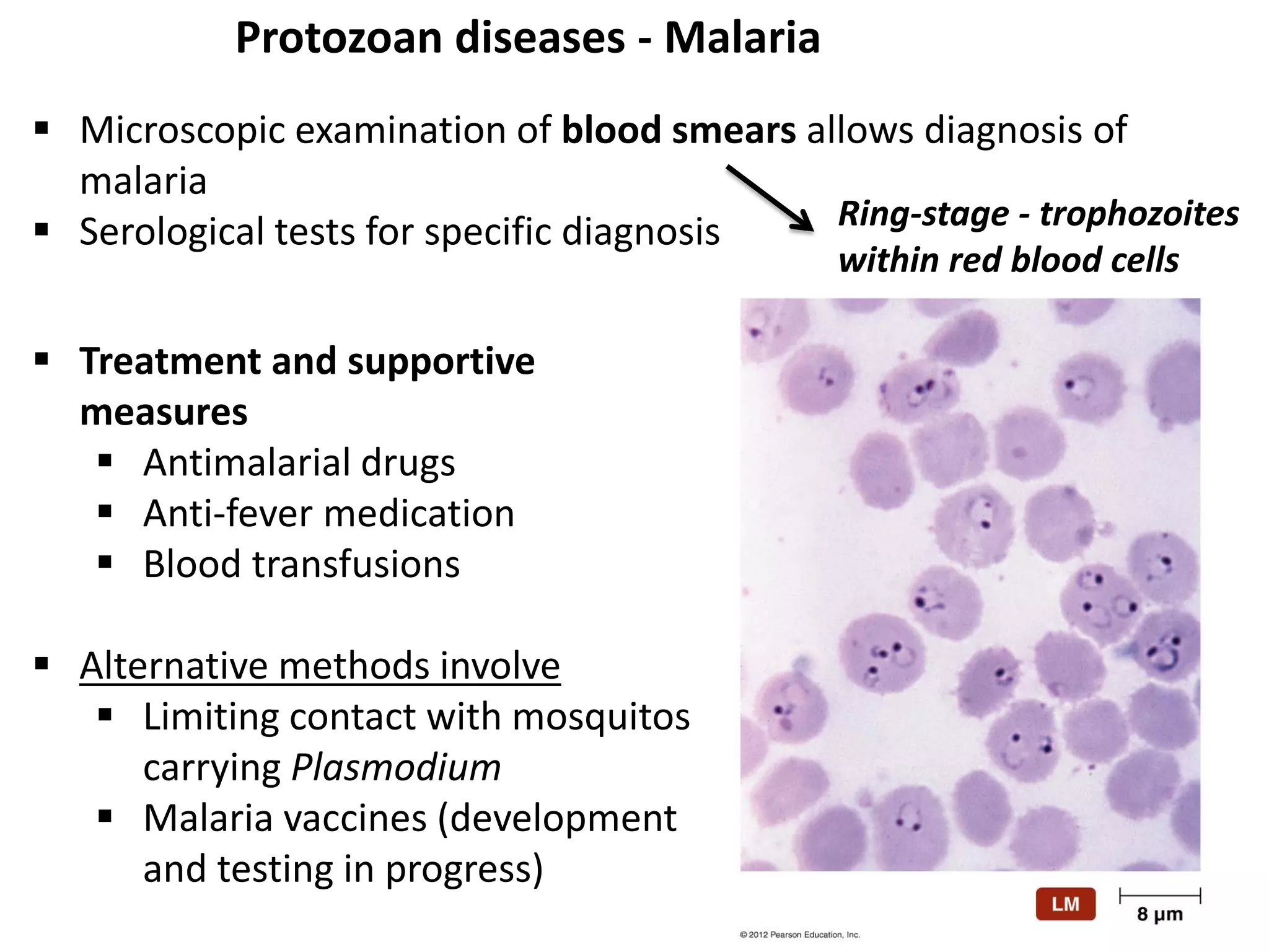 Protozoan diseases - Malaria
Ring-stage - trophozoites
within red blood cells
 Microscopic examination of blood smears allows diagnosis of
malaria
 Serological tests for specific diagnosis
 Treatment and supportive
measures
 Antimalarial drugs
 Anti-fever medication
 Blood transfusions
 Alternative methods involve
 Limiting contact with mosquitos
carrying Plasmodium
 Malaria vaccines (development
and testing in progress)
 