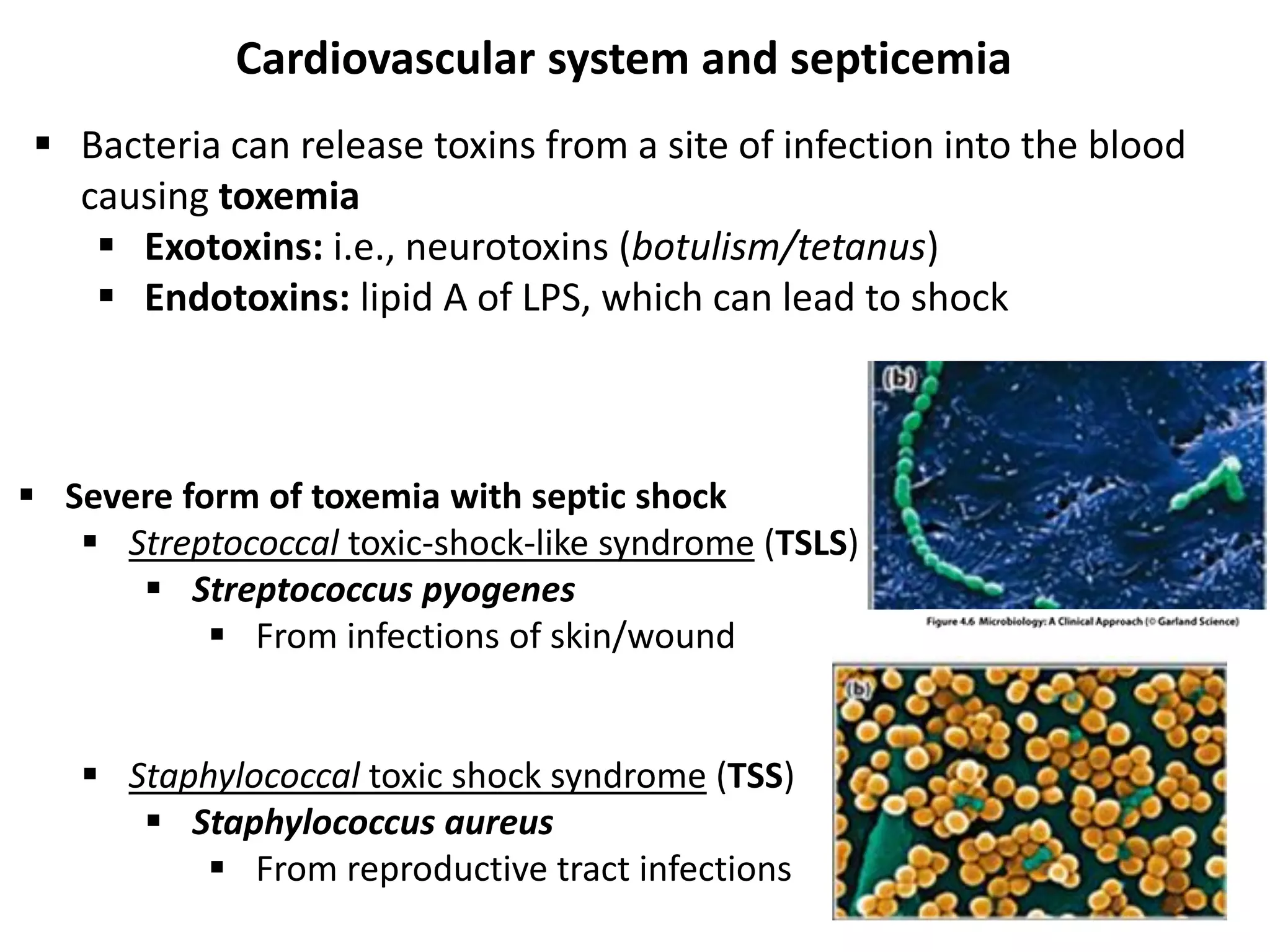  Bacteria can release toxins from a site of infection into the blood
causing toxemia
 Exotoxins: i.e., neurotoxins (botulism/tetanus)
 Endotoxins: lipid A of LPS, which can lead to shock
 Severe form of toxemia with septic shock
 Streptococcal toxic-shock-like syndrome (TSLS)
 Streptococcus pyogenes
 From infections of skin/wound
 Staphylococcal toxic shock syndrome (TSS)
 Staphylococcus aureus
 From reproductive tract infections
Cardiovascular system and septicemia
 