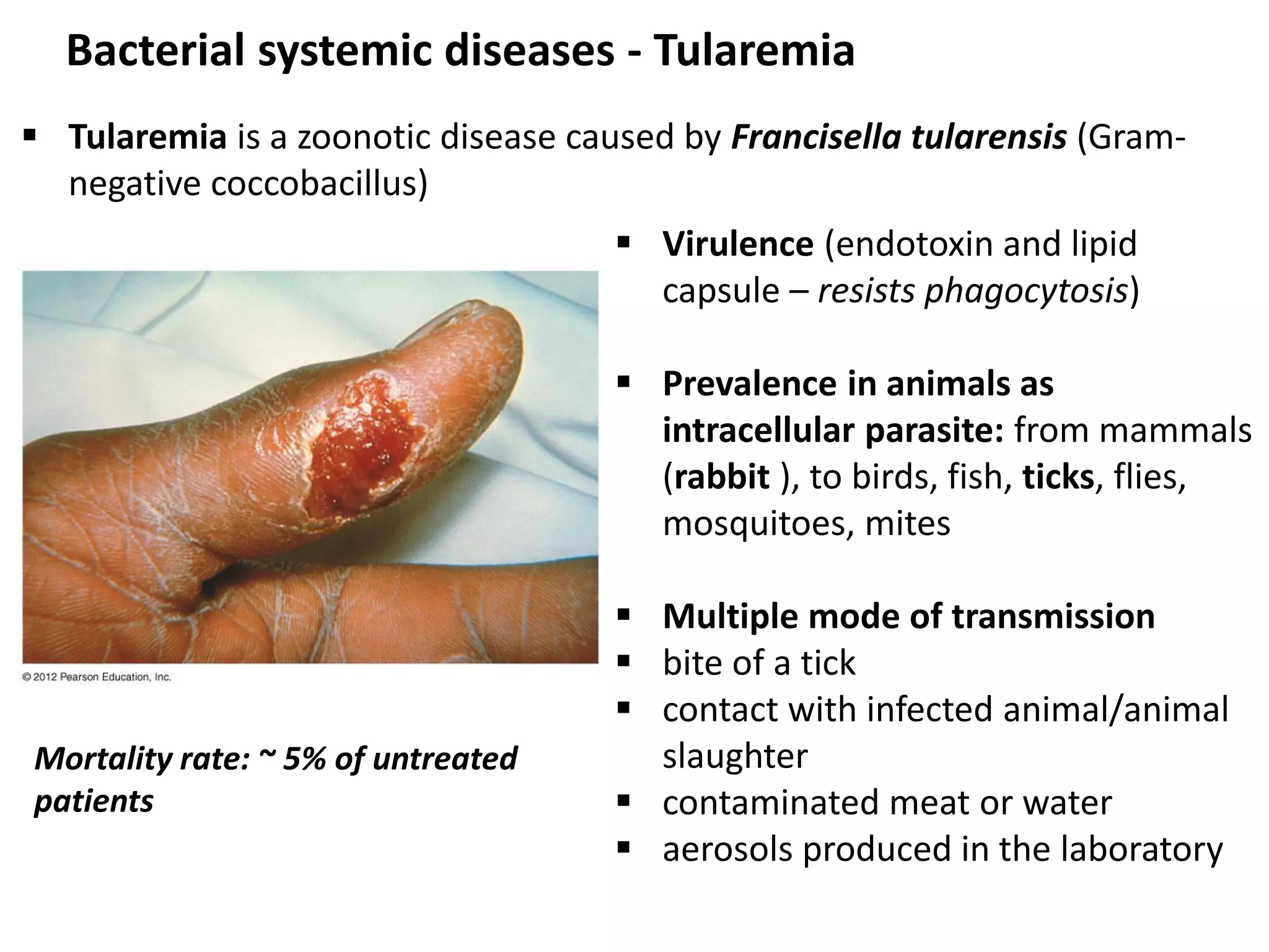 Bacterial systemic diseases - Tularemia
 Tularemia is a zoonotic disease caused by Francisella tularensis (Gram-
negative coccobacillus)
 Virulence (endotoxin and lipid
capsule – resists phagocytosis)
 Prevalence in animals as
intracellular parasite: from mammals
(rabbit ), to birds, fish, ticks, flies,
mosquitoes, mites
 Multiple mode of transmission
 bite of a tick
 contact with infected animal/animal
slaughter
 contaminated meat or water
 aerosols produced in the laboratory
Mortality rate: ~ 5% of untreated
patients
 