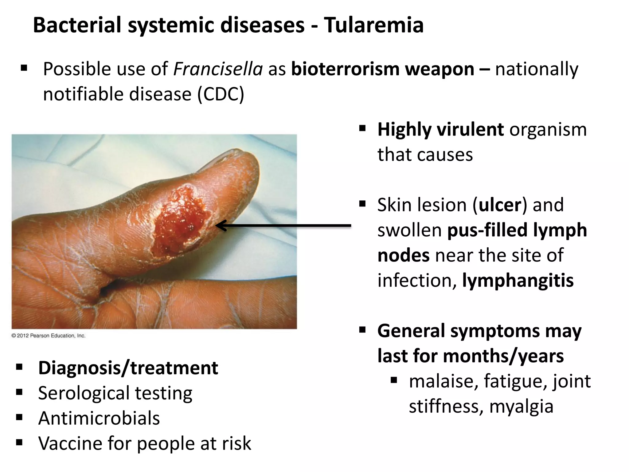 Bacterial systemic diseases - Tularemia
 Highly virulent organism
that causes
 Skin lesion (ulcer) and
swollen pus-filled lymph
nodes near the site of
infection, lymphangitis
 General symptoms may
last for months/years
 malaise, fatigue, joint
stiffness, myalgia
 Diagnosis/treatment
 Serological testing
 Antimicrobials
 Vaccine for people at risk
 Possible use of Francisella as bioterrorism weapon – nationally
notifiable disease (CDC)
 