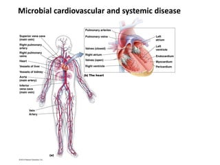 Microbial cardiovascular and systemic disease
 