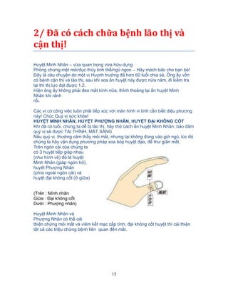 15
2/ Đã có cách chữa bệnh lão thị và
cận thị!
Huyệt Minh Nhãn – vừa quan trọng vừa hữu dụng
Phòng chứng mệt mỏi/đục thủy tinh thể/ngủ ngon – Hãy mách bảo cho bạn bè!
Đây là câu chuyện do một vị Huynh trưởng đã hơn 60 tuổi chia sẻ, Ông ấy vốn
có bệnh cận thị và lão thị, sau khi xoa ấn huyệt này được nửa năm, đi kiểm tra
lại thì thị lực đạt được 1.2.
Hiện ông ấy không phải đeo mắt kính nữa, thỉnh thoảng lại ấn huyệt Minh
Nhãn khi rảnh
rỗi.
Các vị có công việc luôn phải tiếp xúc với màn hình vi tính cần biết diệu phương
này! Chúc Quý vị sức khỏe!
HUYỆT MINH NHÃN, HUYỆT PHƯỢNG NHÃN, HUYỆT ĐẠI KHÔNG CỐT
Khi đã có tuổi, chúng ta dễ bị lão thị, hãy thử cách ấn huyệt Minh Nhãn, bảo đảm
quý vị sẽ được TAI THÍNH, MẮT SÁNG
Nếu quý vị thường cảm thấy mỏi mắt, nhưng lại không đúng vào giờ ngủ, lúc đó
chúng ta hãy vận dụng phương pháp xoa bóp huyệt đạo, để thư giãn mắt.
Trên ngón cái của chúng ta
có 3 huyệt tiếp giáp nhau
(như hình vẽ) đó là huyệt
Minh Nhãn (giáp ngón trỏ),
huyêt Phượng Nhãn
(phía ngoài ngón cái) và
huyệt đại không cốt (ở giữa)
(Trên : Minh nhãn
Giữa : Đại không cốt
Dưới : Phượng nhãn)
Huyệt Minh Nhãn và
Phượng Nhãn có thể cải
thiện chứng mỏi mắt và viêm kết mạc cấp tính, đại không cốt huyệt thì cải thiện
tất cả các triệu chứng bệnh liên quan đến mắt.
 