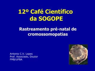 12º Café Científico  da SOGOPE Rastreamento pré-natal de cromossomopatias Antonio C.V. Lopes Prof. Associado, Doutor FMB/UFBA 