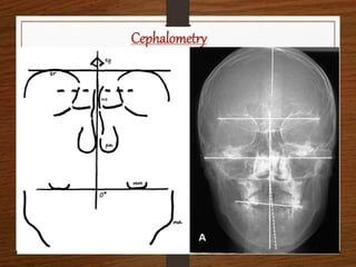Cephalometry
 