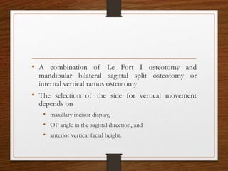 • A combination of Le Fort I osteotomy and
mandibular bilateral sagittal split osteotomy or
internal vertical ramus osteotomy
• The selection of the side for vertical movement
depends on
• maxillary incisor display,
• OP angle in the sagittal direction, and
• anterior vertical facial height.
 