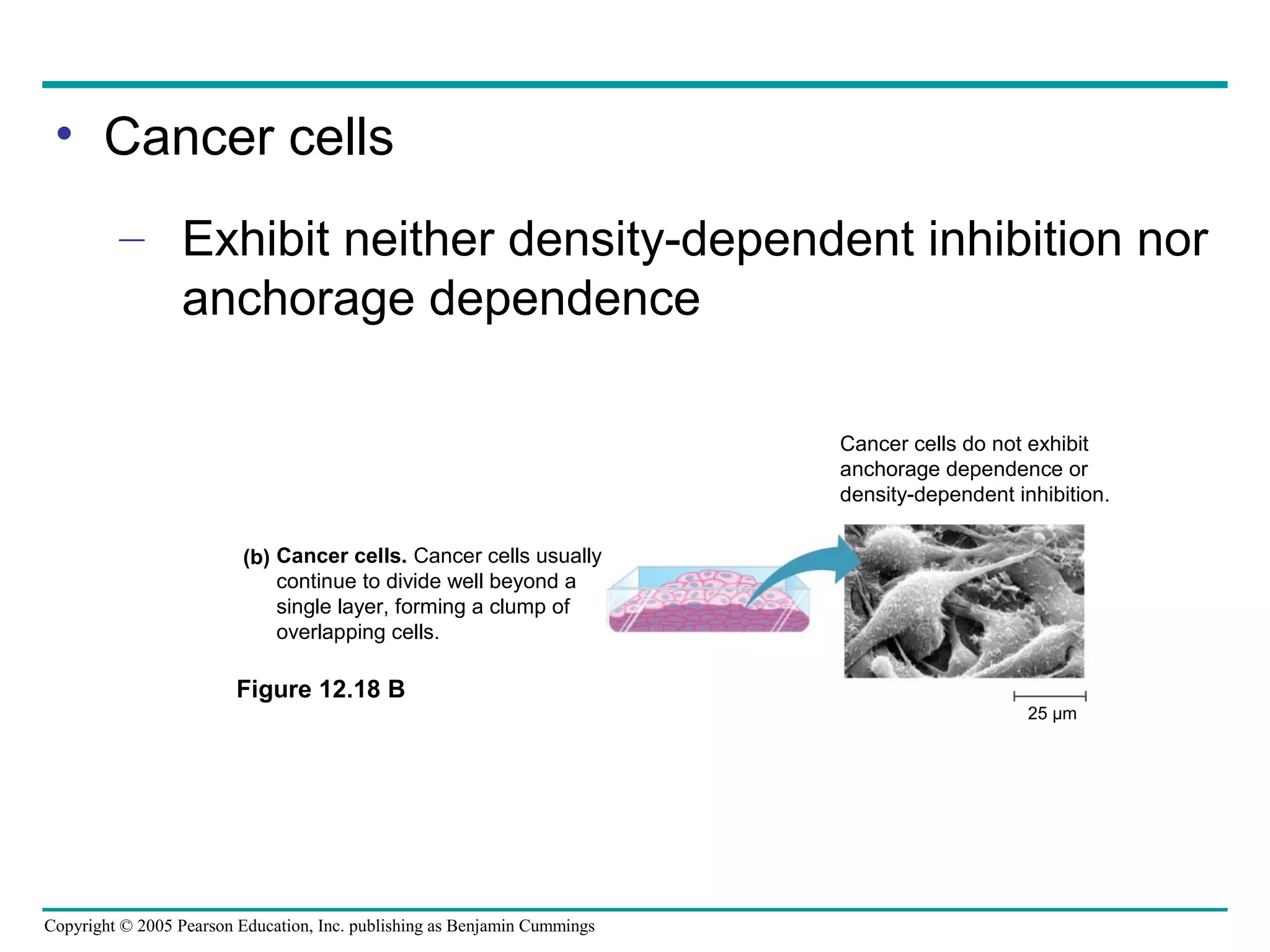 • Cancer cells
– Exhibit neither density-dependent inhibition nor
anchorage dependence
Cancer cells do not exhibit
anchorage dependence or
density-dependent inhibition.
(b) Cancer cells. Cancer cells usually
continue to divide well beyond a
single layer, forming a clump of
overlapping cells.

Figure 12.18 B
25 µm

Copyright © 2005 Pearson Education, Inc. publishing as Benjamin Cummings

 